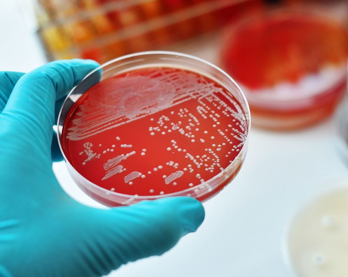 Bakterium Petri 1000 1200x957