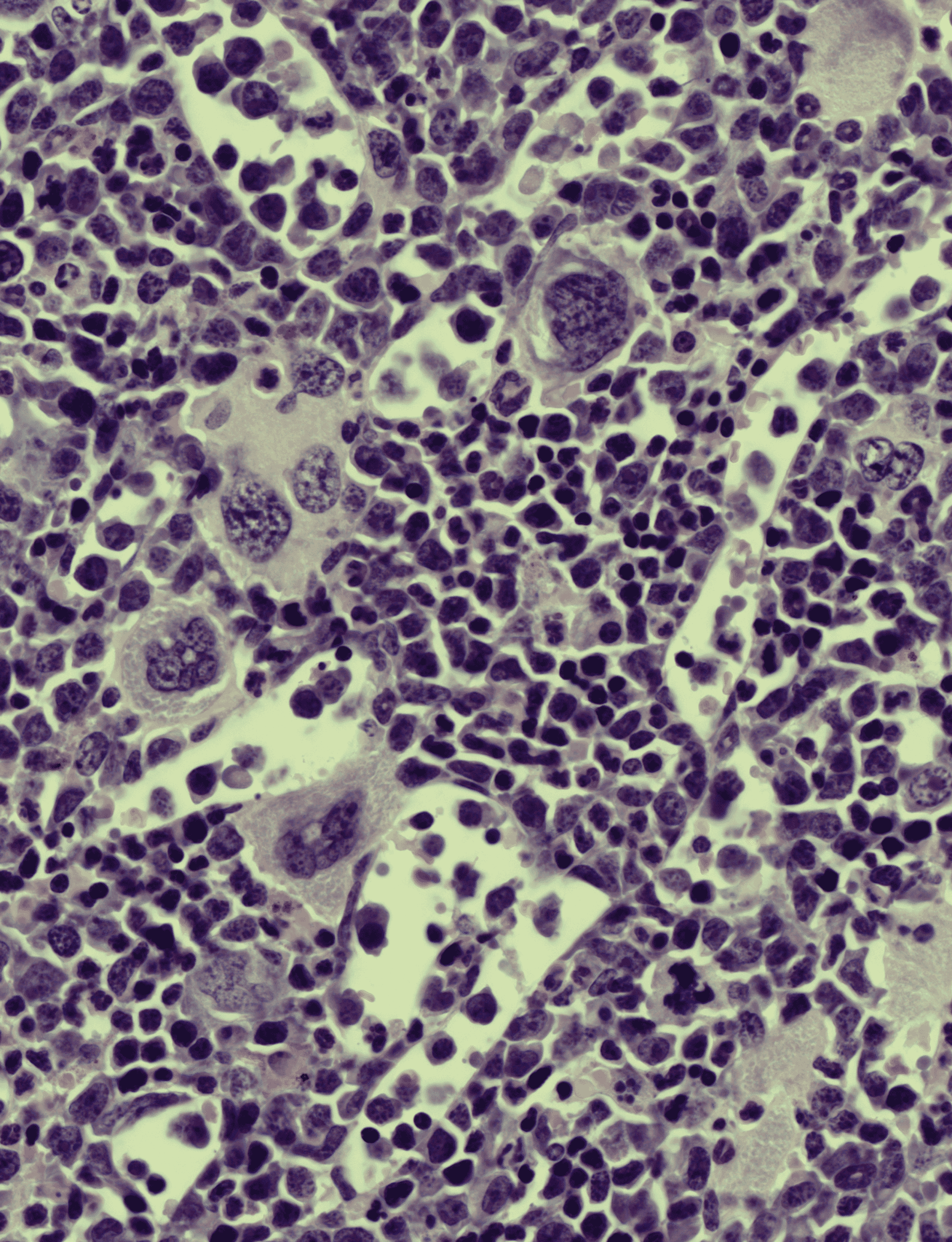 Bloodjournal 147 15.coverfig