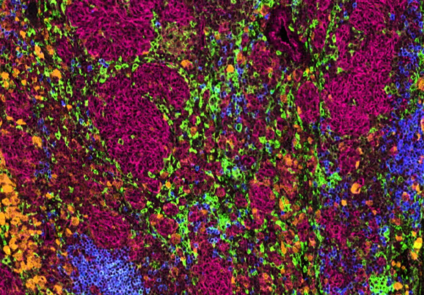 B085d566 B481 4ace B944 76591f4fef1e Example+IMC+image Bodenmiller+Lab